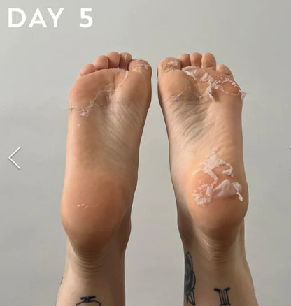 BeautyPro Foot And Callus Peel